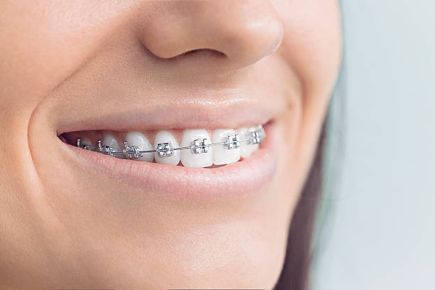 Best Full Mouth Reconstruction  in Winnfield, LA